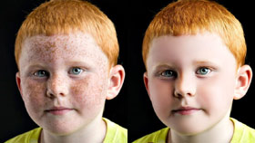 Photoshop完美的消除小男孩满脸的斑点